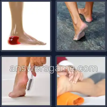 4 Bilder 1 Wort 5 Buchstaben FERSE