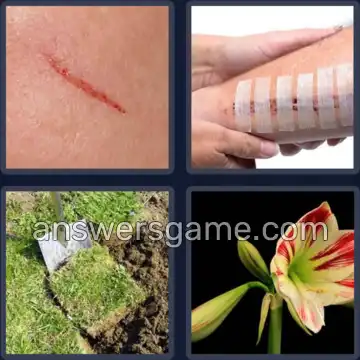 4 Bilder 1 Wort 5 Buchstaben NARBE