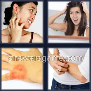 4 Bilder 1 Wort 7 Buchstaben JUCKEND