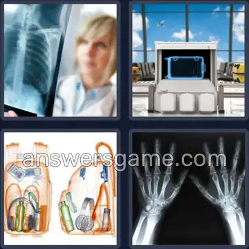 4 Bilder 1 Wort 7 Buchstaben RÖNTGEN