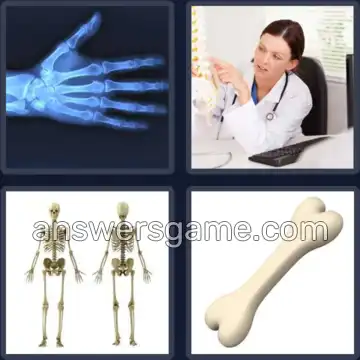 4 Pics 1 Word 4 Letters BONE