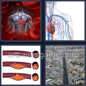 4 Pics 1 Word 6 Letters ARTERY