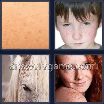 4 Pics 1 Word 8 Letters FRECKLES