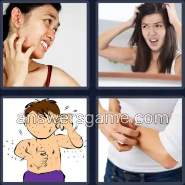 4 Images 1 Mot 6 lettres PRURIT