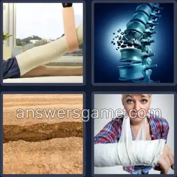 4 Images 1 Mot 8 lettres FRACTURE