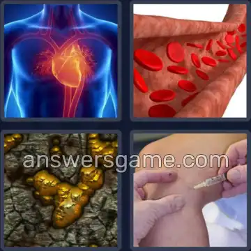 4 Plaatjes 1 Woord 4 letters ADER